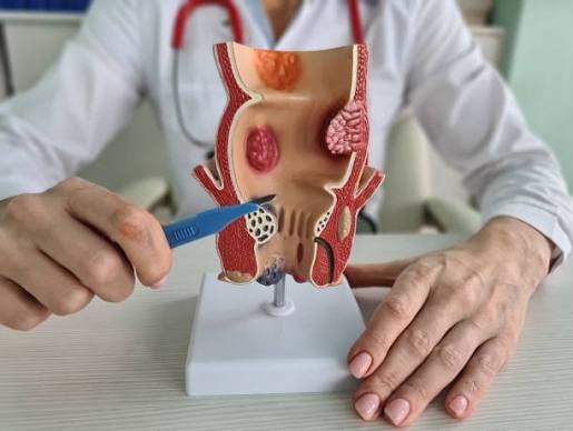Best Colorectal surgical care Doctor in Dadar